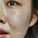 Set für Empfindliche & Trockene Haut