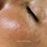 Hydrating Skin Repair Serum