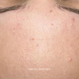 Prebiotic Skin Recharge Treatment