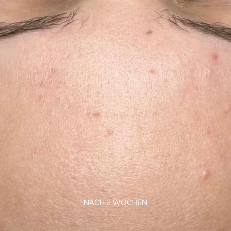 Prebiotic Skin Recharge Treatment