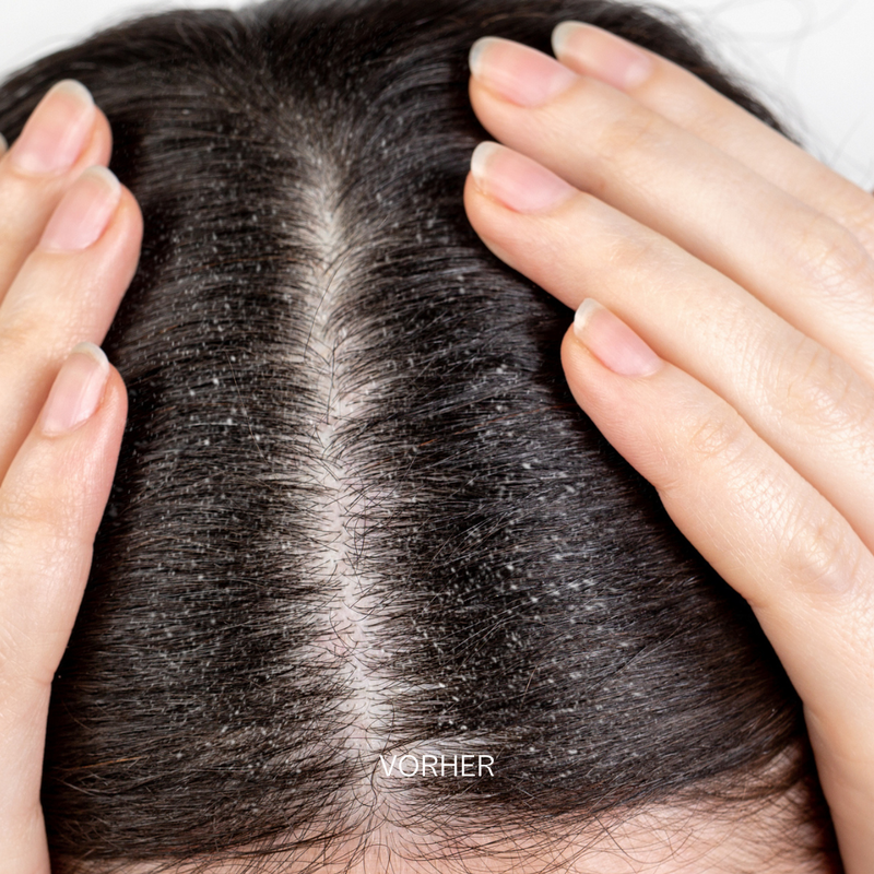 Scalp & Hair Detox Mask Geschenk