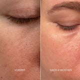 Elena´s 24h Deep Regeneration & Lifting Duo